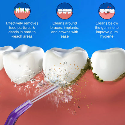 Replacement Floss Tips for Deep Clean Dental Water Flosser 2.0 XL